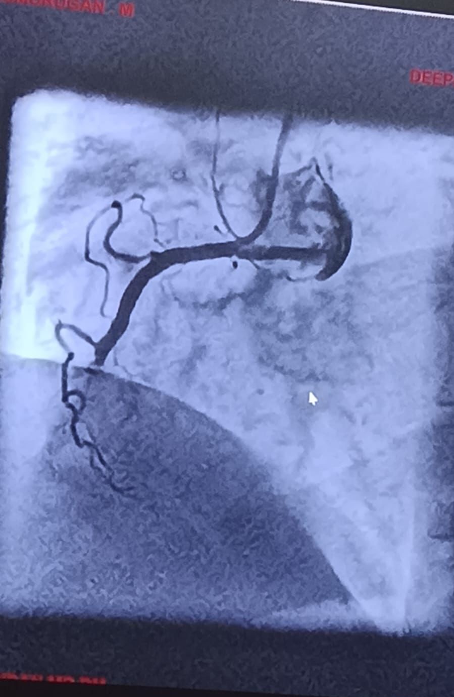 Medical Angiogram Image 6